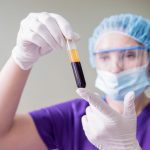 plasma-preparation-tube-scaled