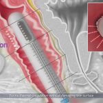 rBVaVFy6ximACVOKAAM02wnHjl0881